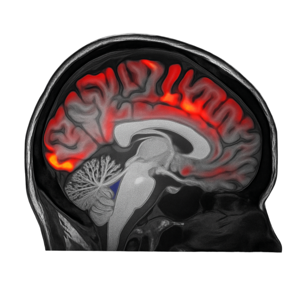 Actividad cerebral